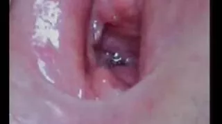 සුදු බැල්ලියෝ යෝනි මුඛය